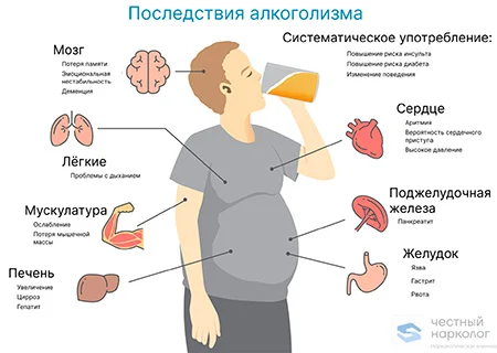 Инфографика